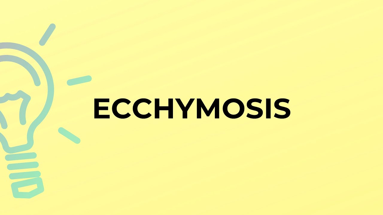 What is the meaning of the word ECCHYMOSIS?