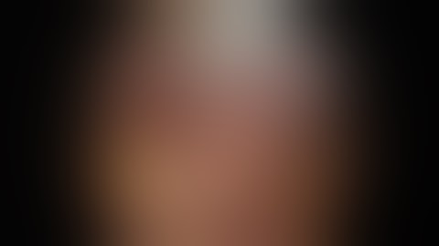 Laparoscopic-assisted transgastric ERCP after MGB/OAGB