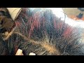 Cleansing a very dirty scalp| dandruff cleansing