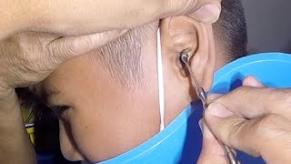Something Huge Stuck in Boy's E...