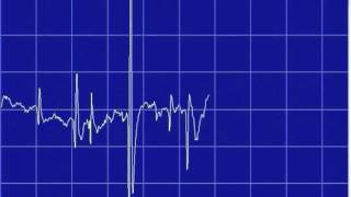 Fibs.wmv