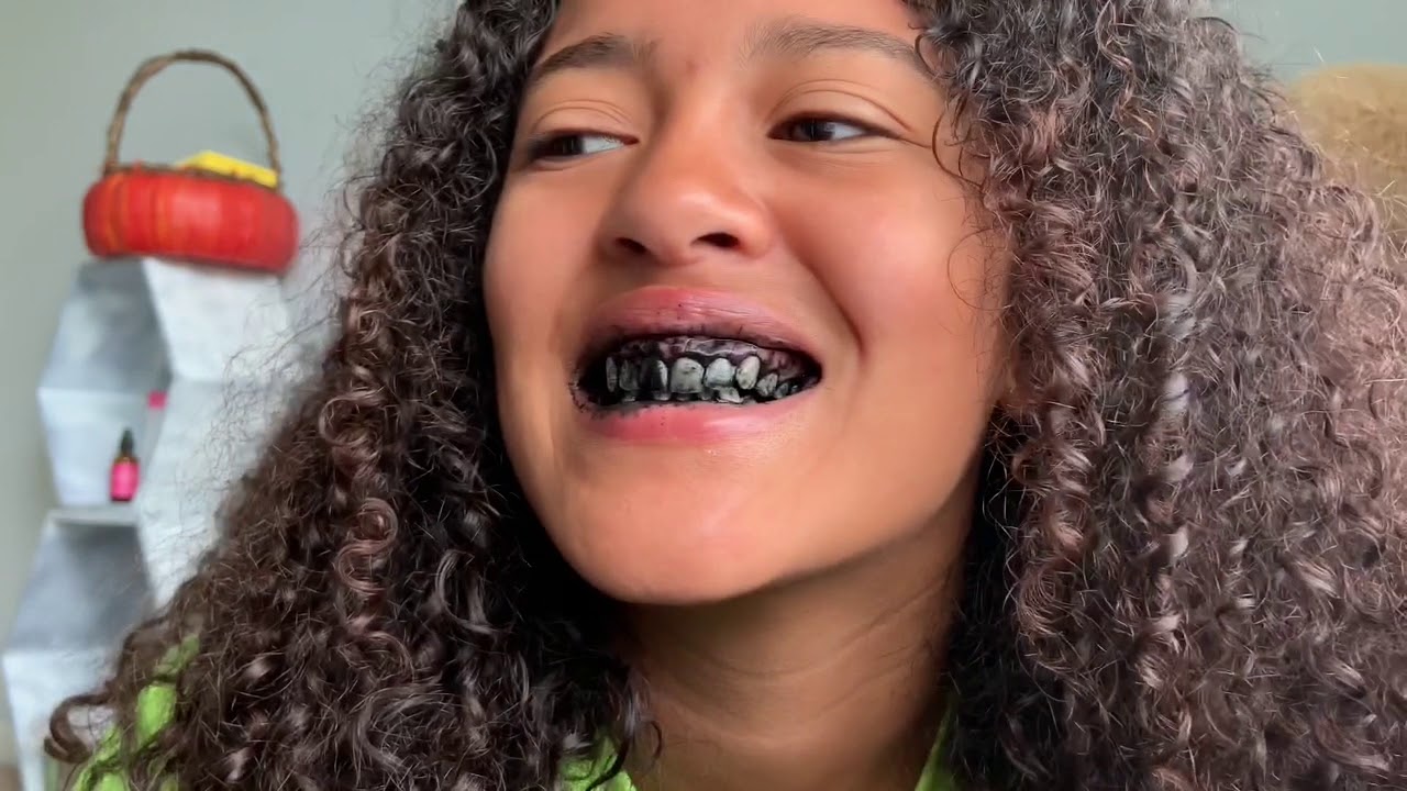 Black Stuff On Teeth - TeethWalls