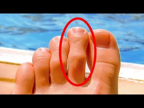 Sağlıksız Olduğunuzu Gösteren 10 Endişe Verici İşaret