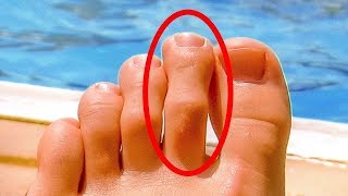 Sağlıksız Olduğunuzu Gösteren 10 Endişe Verici İşaret