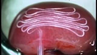 Researchers Implant a Cell Fiber into a Mouse Kidney