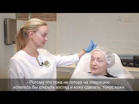 ЛАЗЕРНАЯ БЕЗОПЕРАЦИОННАЯ БЛЕФАРОПЛАСТИКА