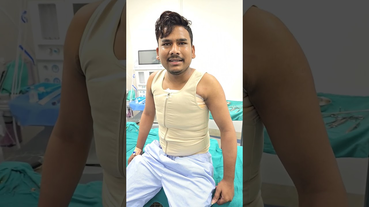 Gynecomastia surgery result