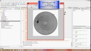 ANALYSIS OF RETINAL BLOOD VESSELS USING IMAGE PROCESSING TECHNIQUES