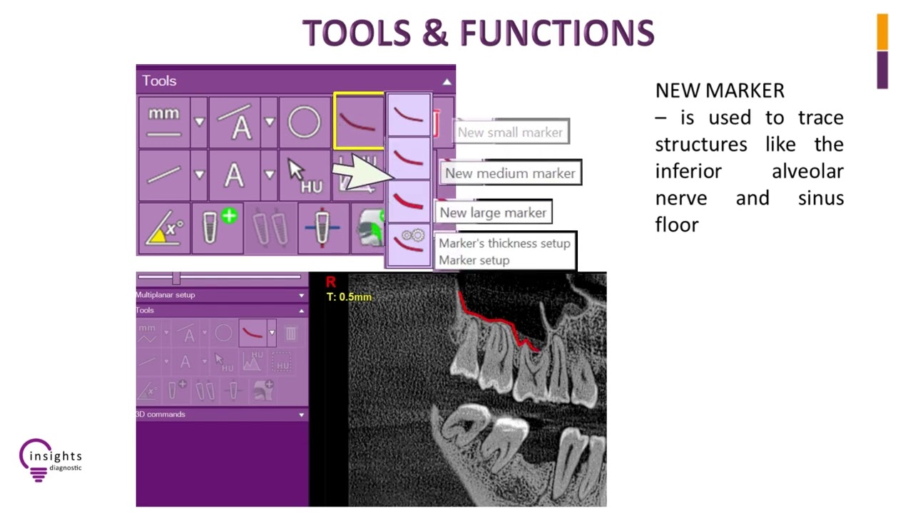 Insights Diagnostic - iRYS Software Tutorial - Tools and Functions