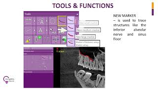 Celebrity Insights Diagnostic - iRYS Software Tutorial - Tools and Functions Wealth