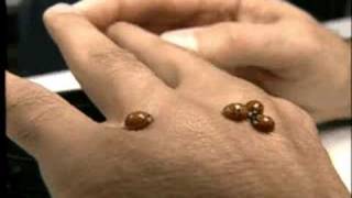 Do Ladybugs Bite Which Ones Why And What To Do About It