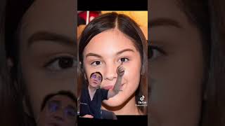 olivia rodrigo plastic surgery Information