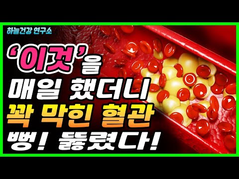 <strong>50대부터</strong> 조심해야 하는 혈관질환! 이것으로 해결하세요! 부위별 혈전 증상과 해결법