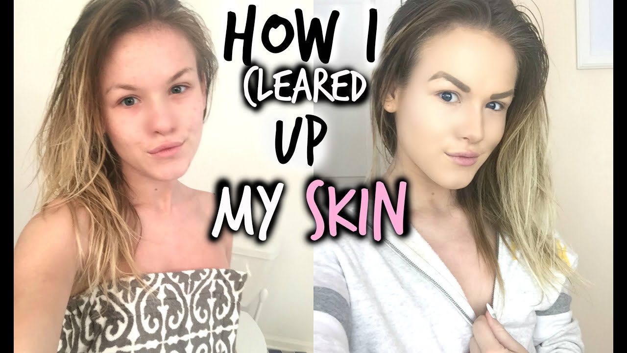 My Winter Skincare Routine | How I Cleared My Skin - YouTube