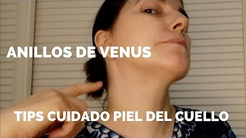 ¿Qué son los anillos de Venus en el cuello?