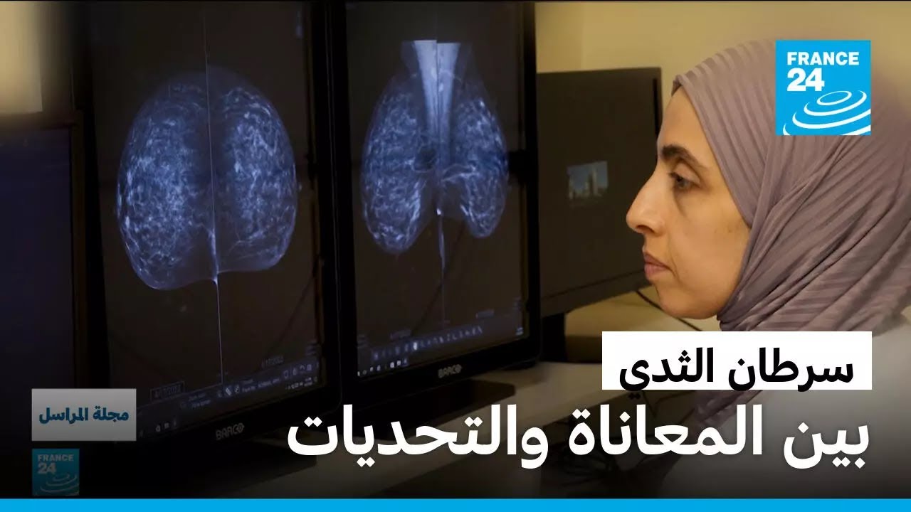  :      24 / FRANCE 24
 - نشر قبل 59 دقيقة