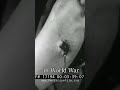 Why You Never Touched an Abdominal Wound