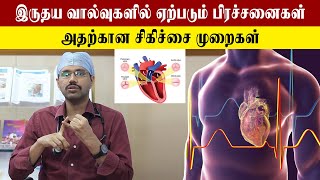 Valve Heart Disease Treatment Part-2 இரதய வலவ சரநத சகசச மறகள எனன? Samayam Tamil