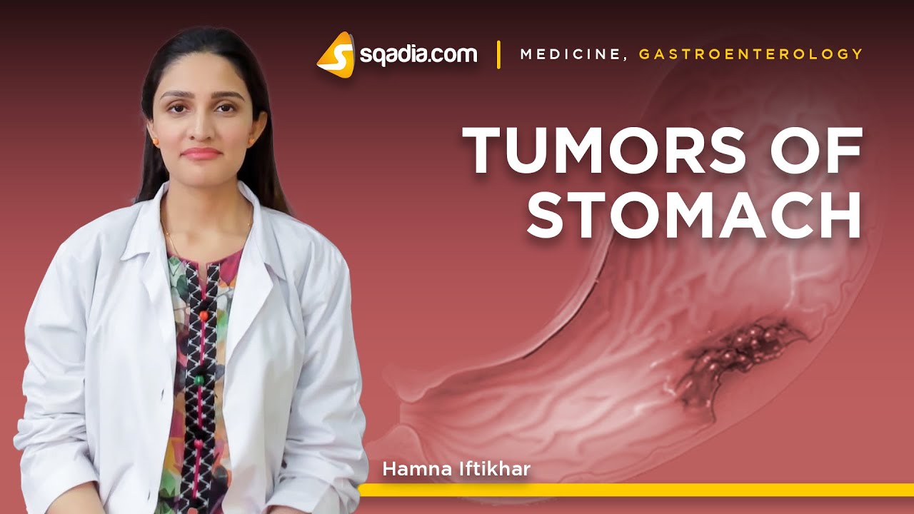 Tumors of Stomach | Gastric Cancer Prevention | Gastroenterology Lecture | V-Learning™