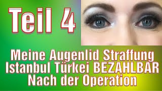 Facelift OP mit Halsstraffung VORHER / NACHER Ergebnis 50-jährige Patientin | Dr. Walther Jungwirth