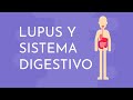 Lupus y sistema digestivo