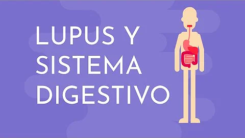 ¿Afecta el lupus al estómago?