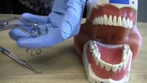 How to use Sectional Matrix Tor Vm | Filay Dent Dental Matrices System