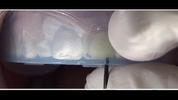 composite injection technique