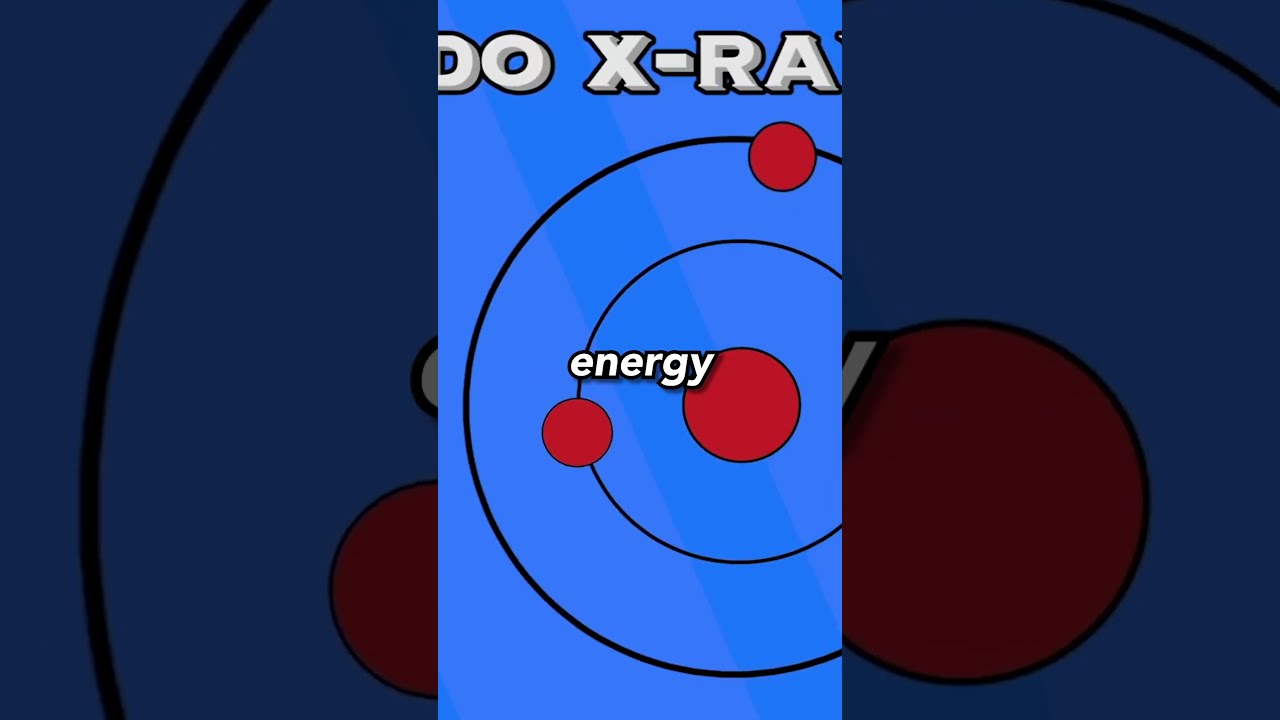 How Do X Rays Work YouTube How Do X Rays Work YouTube