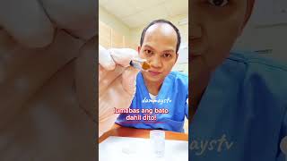 EPEKTIBO ITO SA MAY BATO SA BATO