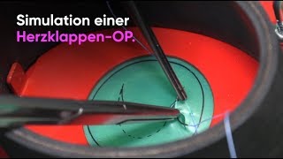 bung Macht Den Meister  Auch In Der Herzchirurgie