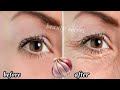 Download Lagu 54 years old and looks 20 | Anti-aging remedy to eliminate wrinkles from the first week