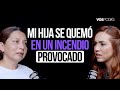 MI HIJA SE QUEMÓ EN UN INCENDIO PROVOCADO (CON JOHANA MAYA) I Vos podés el podcast  - EP 209 I