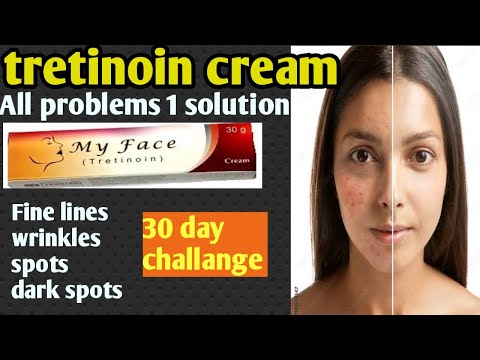 How Does Retin-A (Tretinoin) Improve the Skin? from YouTube · Duration:  2 minutes  · 9,1K views · uploaded on Jul 15, 2017 · uploaded by Adam Scheiner, MD · Click to play.