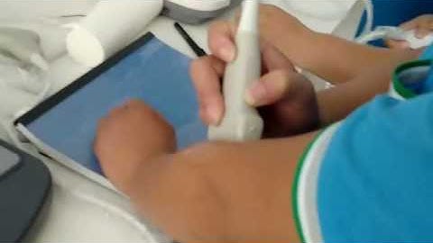 DW C60 with linear probe