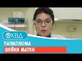 👩 1485  Папиллома шейки матки