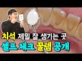 치석 셀프로 확인 가능할까요?! '이것'만 있으면 집에서도 간단하게 확인할 수 있습니다!