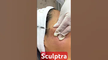 استرجعى جمالك وشبابك سكلبترا لتجديد وشد الوجة تجميل Lipfiller Beauty Skincare Lips 