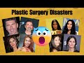 Top 10 WORST Celebrity Plastic Surgery Disasters: Surgeons React! Mp3 Song