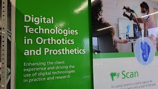 Digital Innovation in Pediatric Orthotics & Prosthetics | Holland Bloorview