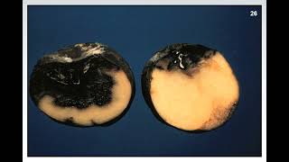 Fundamentals of Plant Diseases - Slide 26 - BACTERIA:  SYMPTOMS:  SOFT ROT screenshot 2