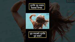 খুশকি দূর করার উপায় haircare haircaretips hairstyle hair health healthtips