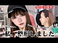 【ガチです】整形しました…メリットデメリットも正直に全部語ります！