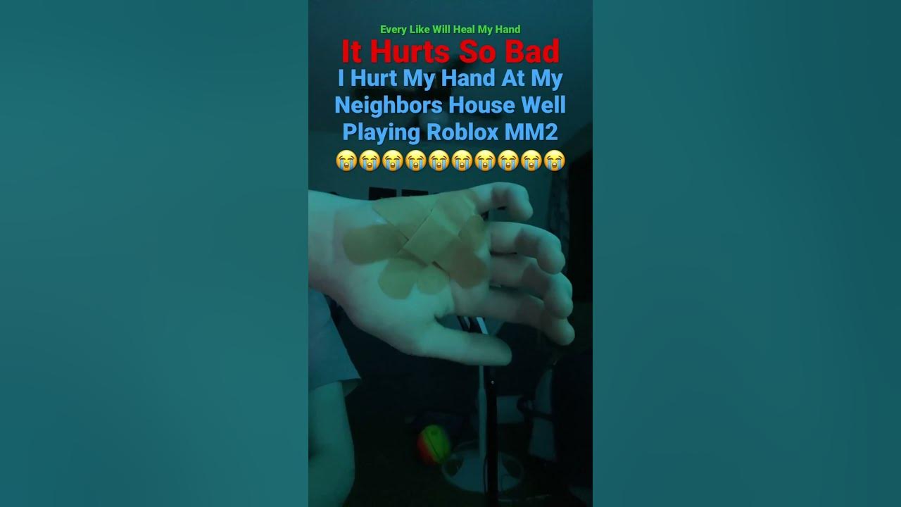 I Hurt My Hand 😭😭 YouTube