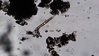 Download Lagu World of Microscopy - a Drop of Pond Water Download Lagu World of Microscopy - a Drop of Pond Water