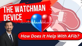 Watchman Device for AFib: Procedure Details, How It Works, and More. by Doctor AFib 52,920 views 1 year ago 14 minutes, 6 seconds