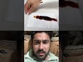 Tissue Ki Help Se Kethup Clean