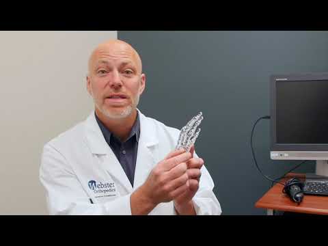 Dr. Joshua C. Richards Talks all about Finger Fracture | Hand Specialist California