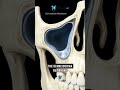 What is a Sinus lift? Implants explained