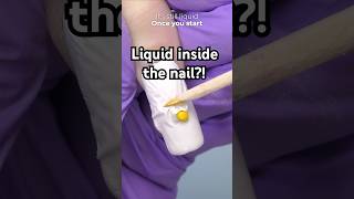 Why is there a liquid gel inside my nail? 😮
